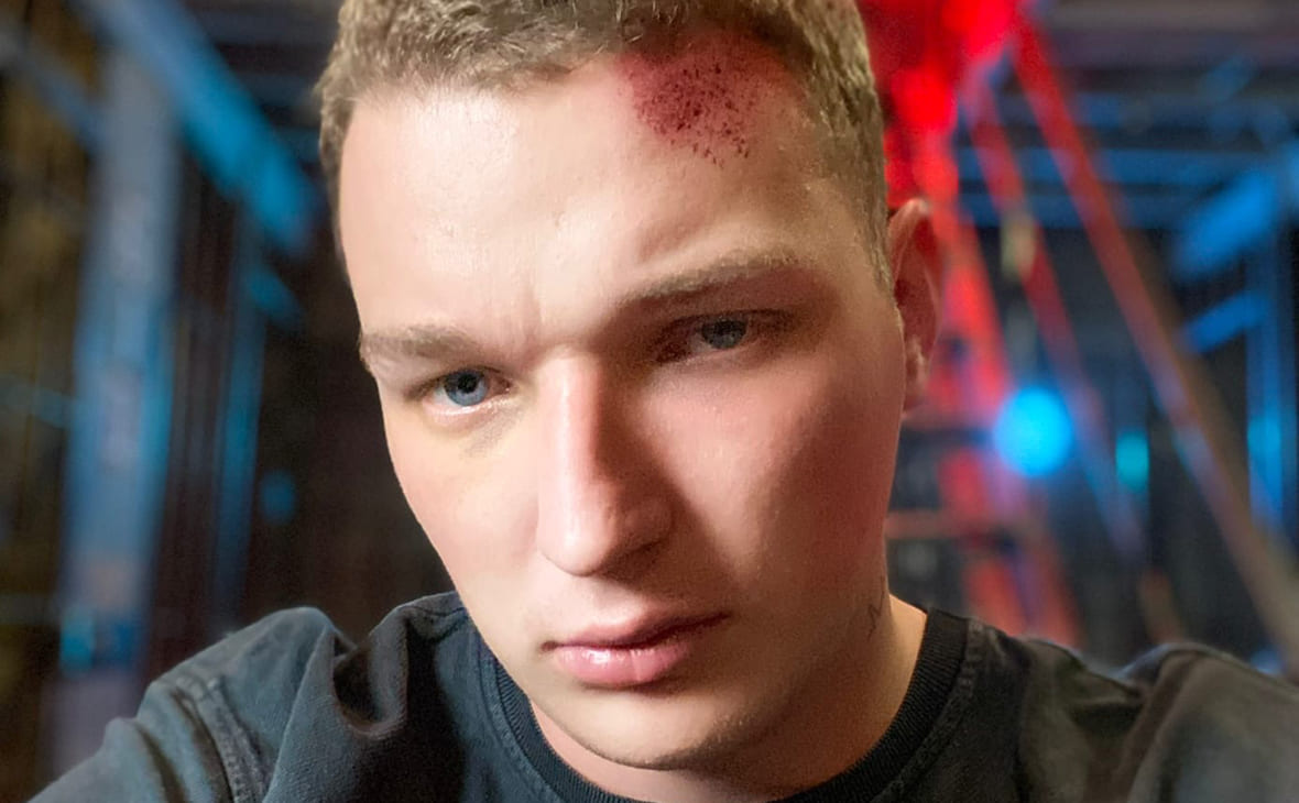 Дело Эдварда Била о ДТП поступило в суд - изображение обложка