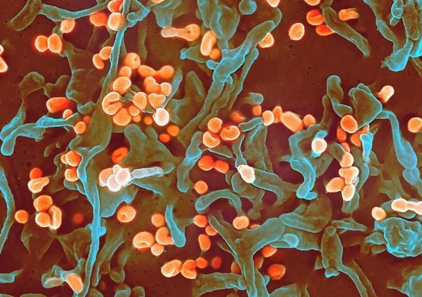 Россияне стали чаще интересоваться вакцинацией от коронавируса - изображение обложка