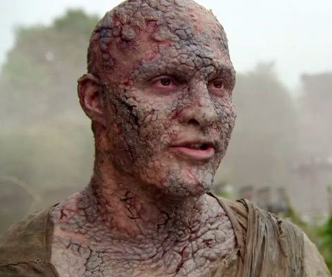 Объяснено: что такое серая хворь в мире «Игры престолов»? - изображение обложка