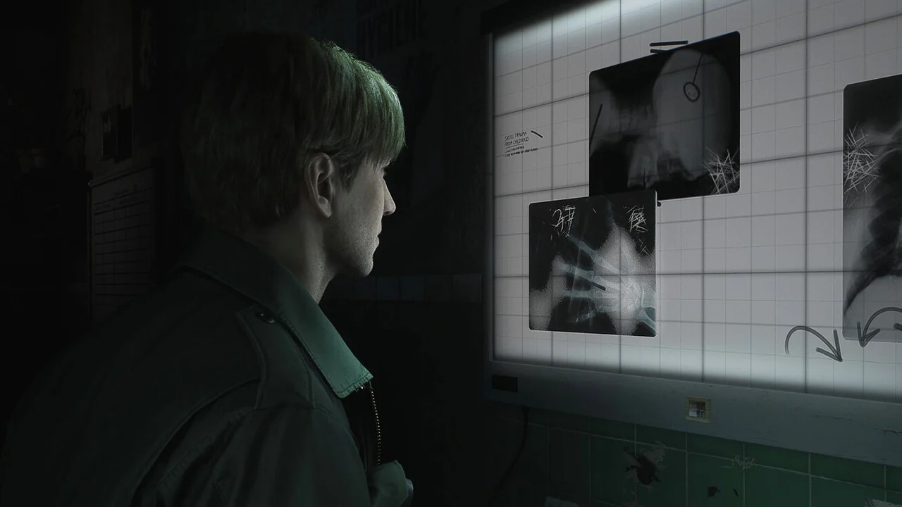 Обложка: скриншот игры Silent Hill 2 Remake