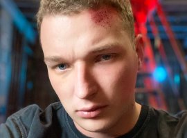 Дело Эдварда Била о ДТП поступило в суд - изображение 1