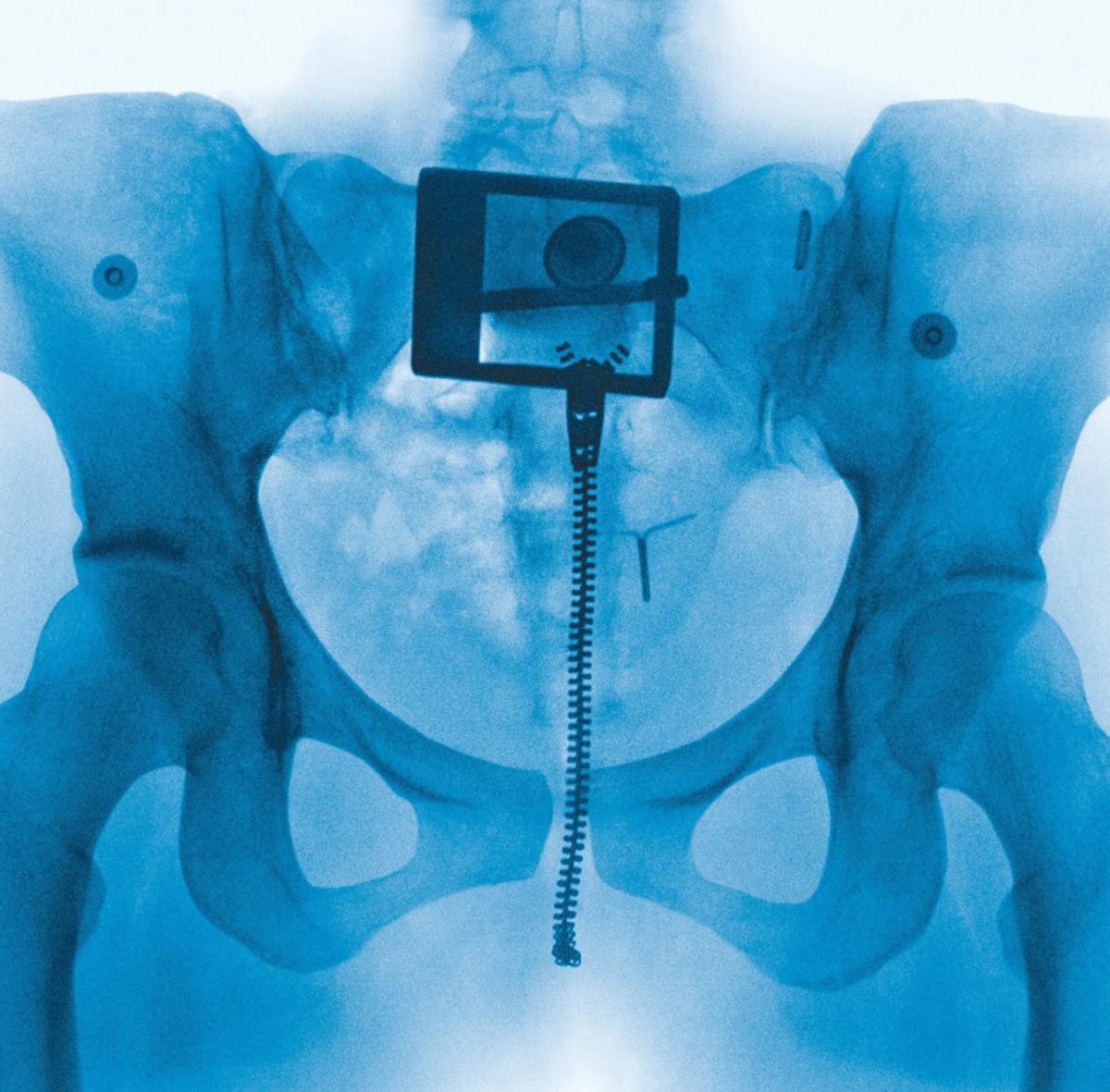 Фанаты Лорд бурно обсуждают оформление пластинки Virgin - фото 1