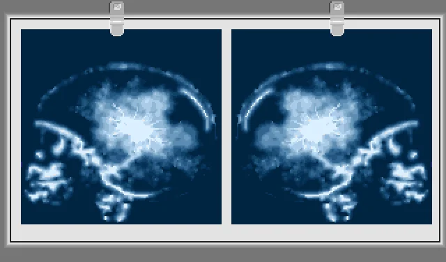 Life & Death 2: The Brain - кадр 6