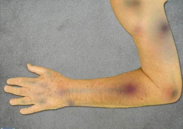 911 Paramedic - кадр 4