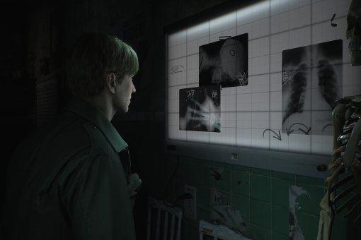 Bloober Team обновила лицо главного героя ремейка Silent Hill 2