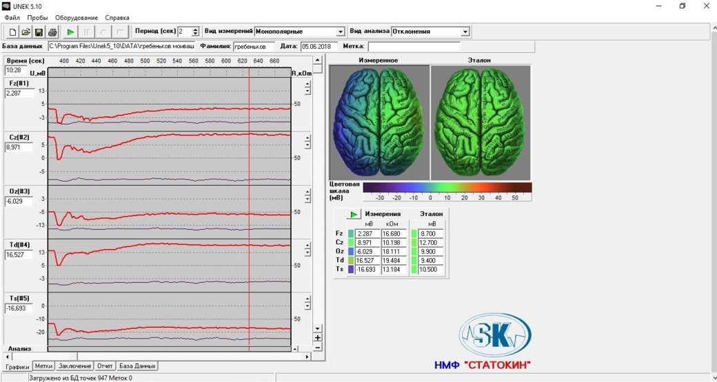 Галерея Исследование: показатели активности мозга во время обычных игр и во время соревнований отличаются - 2 фото